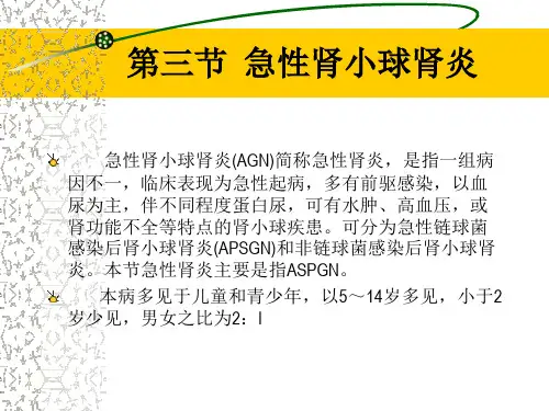 儿童急性肾小球肾炎ppt课件