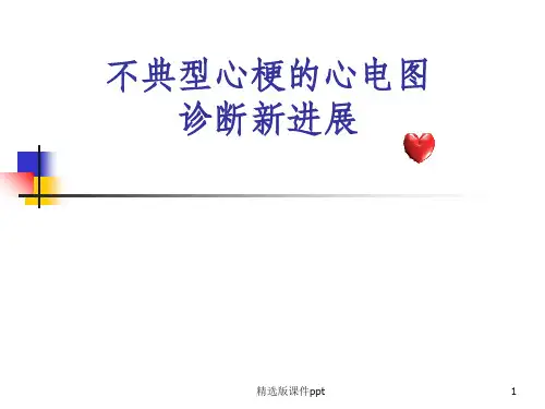 不典型心梗的心电图诊断ppt课件