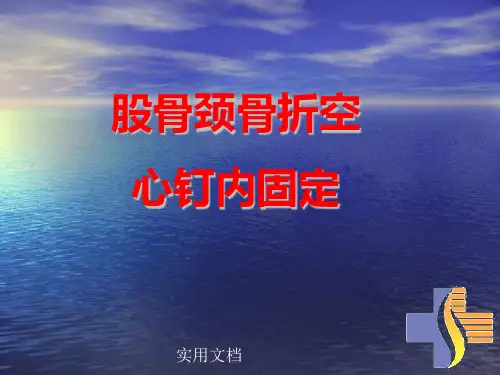 股骨颈骨折空心钉内固定选择