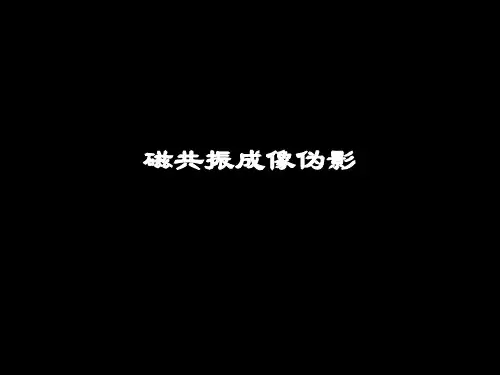 磁共振成像伪影