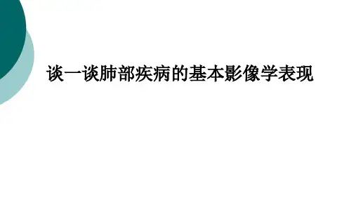肺部疾病基本影像表现