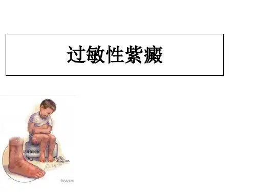 过敏性紫癜PPT课件