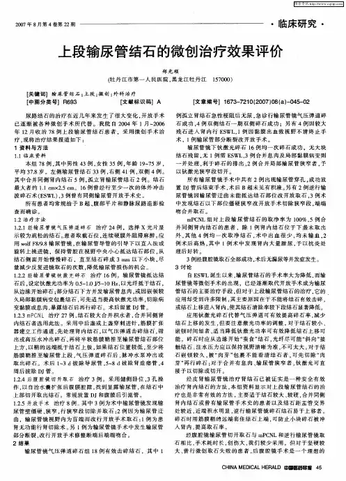 上段输尿管结石的微创治疗效果评价