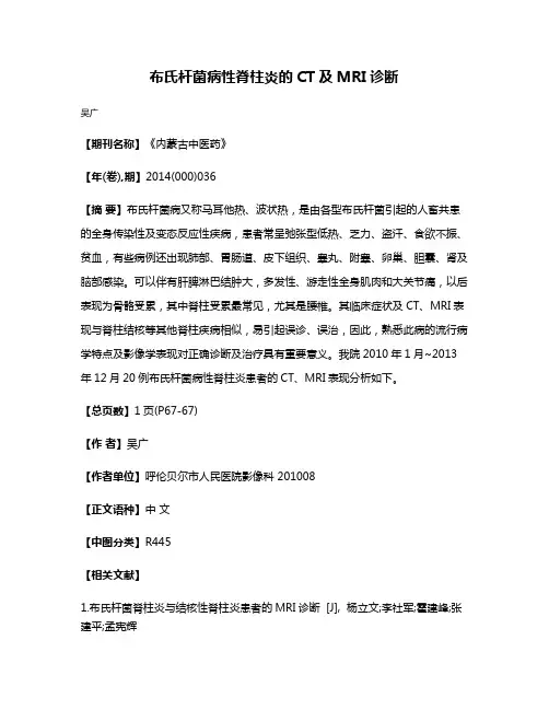 布氏杆菌病性脊柱炎的CT及MRI诊断