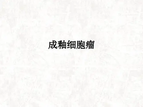 成釉细胞瘤ppt课件