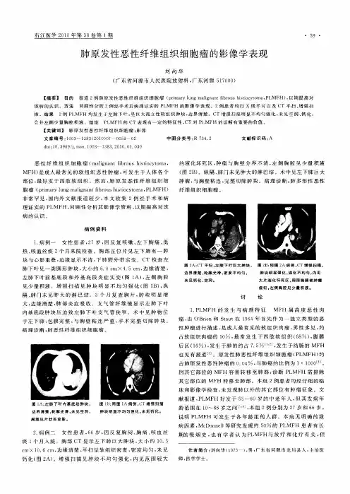 肺原发性恶性纤维组织细胞瘤的影像学表现