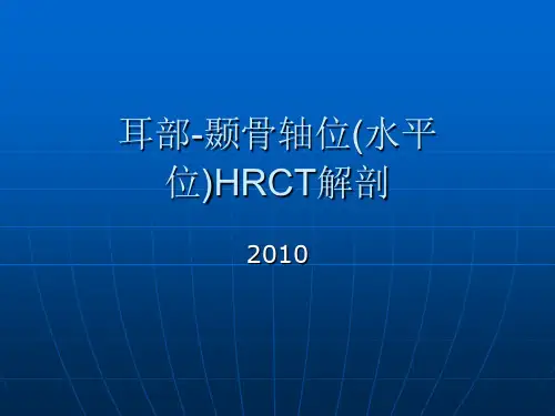耳部-颞骨轴位(