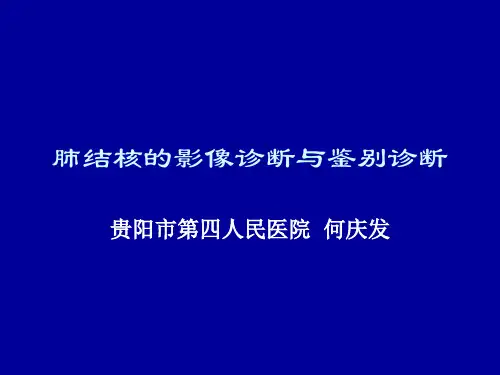 肺结核的影像诊断与鉴别诊断Microsoft PowerPoint 演示文稿