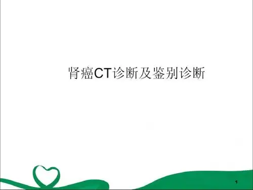 肾癌CT诊断及鉴别PPT演示课件