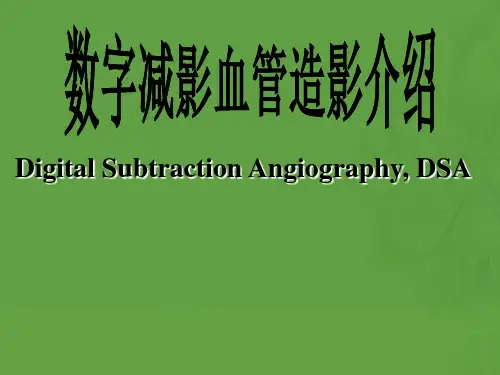 DSA数字减影血管造影介绍