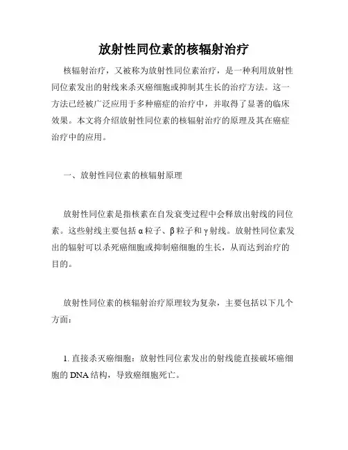 放射性同位素的核辐射治疗
