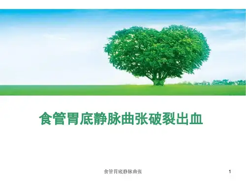 食管胃底静脉曲张ppt课件