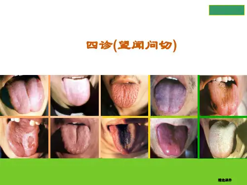 中医诊断学四诊望闻问切演示课件.ppt