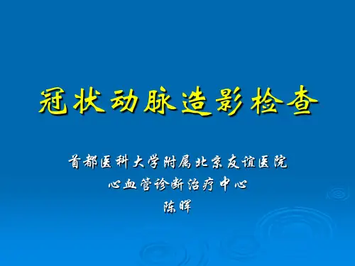 冠状动脉造影检查