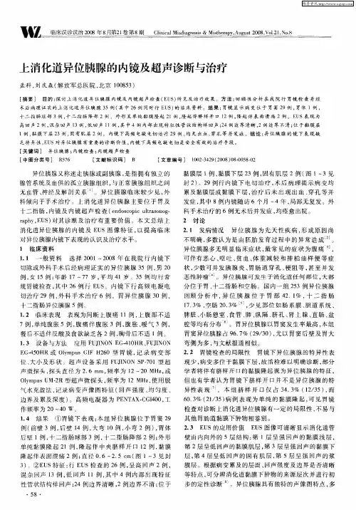 上消化道异位胰腺的内镜及超声诊断与治疗