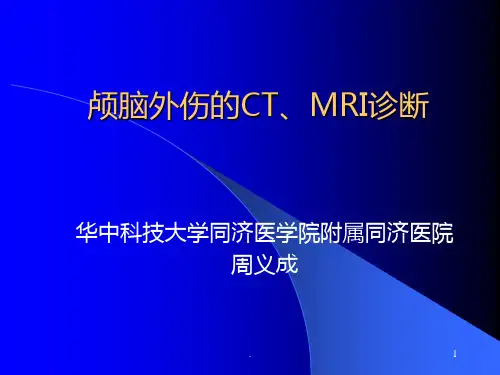 颅脑外伤的CT、MRI诊断PPT课件