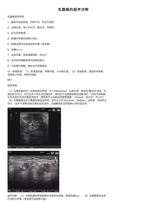 乳腺癌的超声诊断
