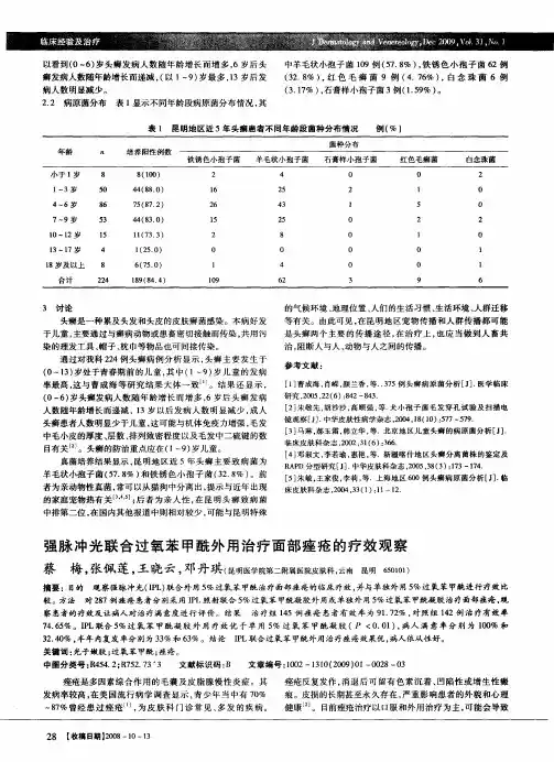强脉冲光联合过氧苯甲酰外用治疗面部痤疮的疗效观察