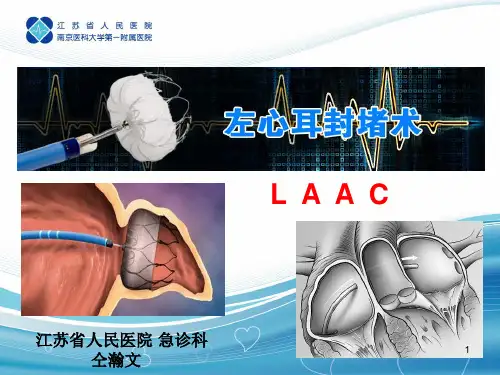 (参考课件)左心耳封堵术