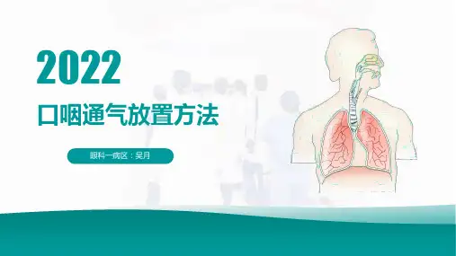 口咽通气道