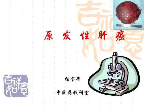 原发性肝癌