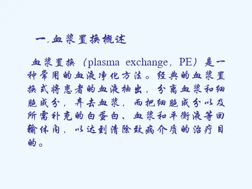 血浆置换