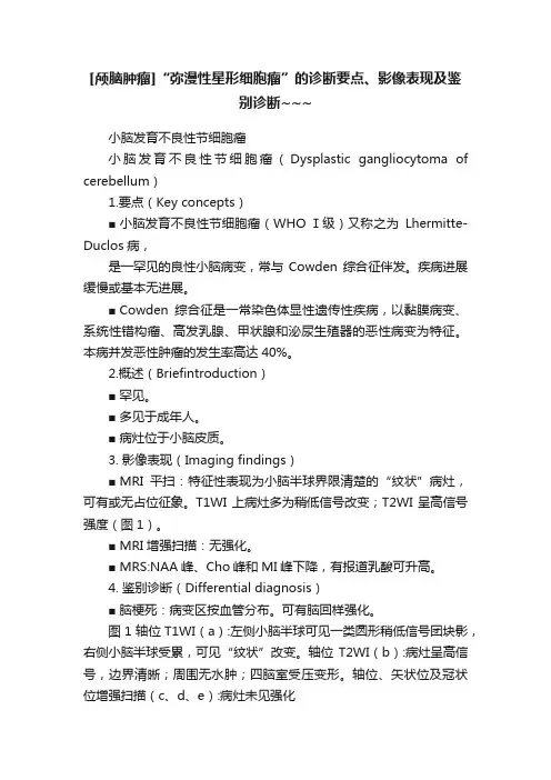 [颅脑肿瘤]“弥漫性星形细胞瘤”的诊断要点、影像表现及鉴别诊断~~~