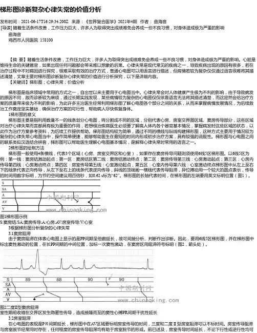 梯形图诊断复杂心律失常的价值分析