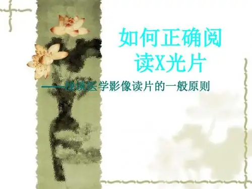 如何正确阅读X光片