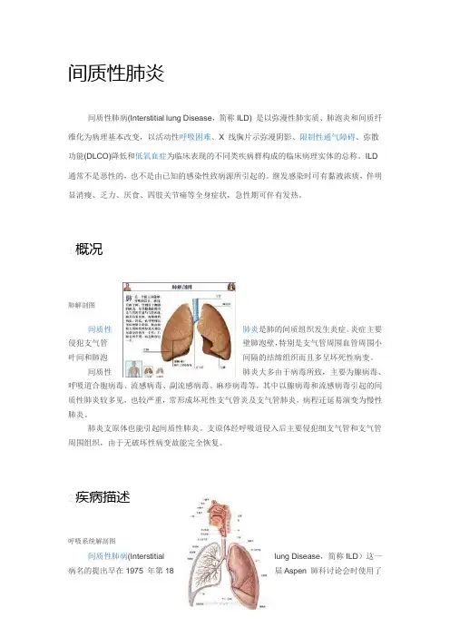 间质性肺炎