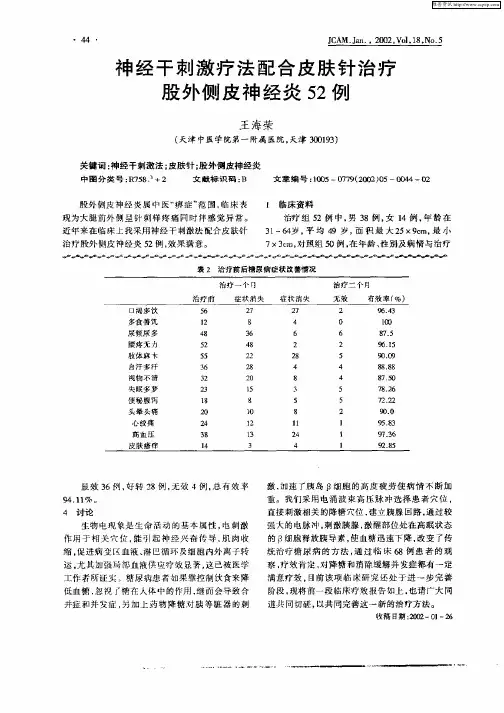 神经干刺激疗法配合皮肤针治疗股外侧皮神经炎52例