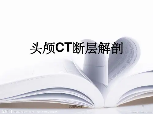 头颅CT断层解剖PPT课件