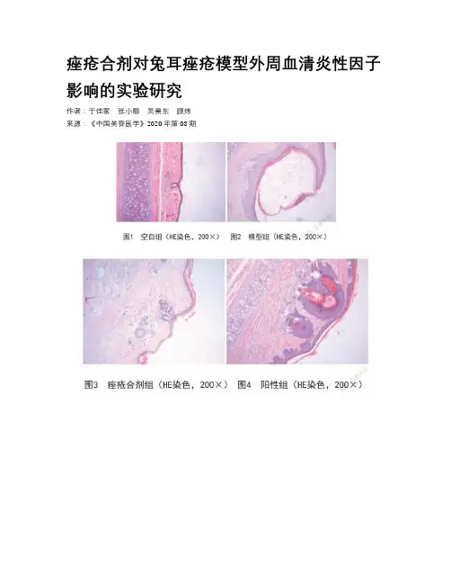 痤疮合剂对兔耳痤疮模型外周血清炎性因子影响的实验研究