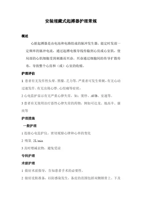 起搏器