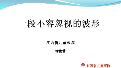快速识别心电图