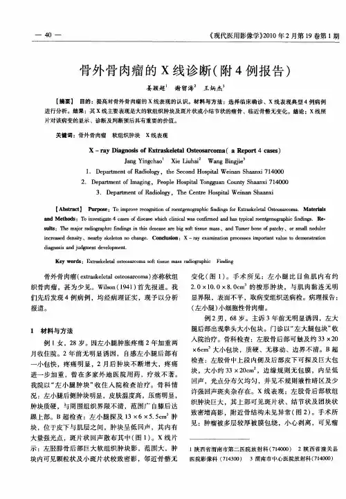 骨外骨肉瘤的X线诊断(附4例报告)