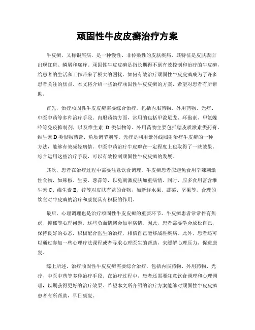 顽固性牛皮皮癣治疗方案
