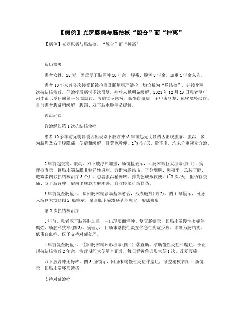 【病例】克罗恩病与肠结核“貌合”而“神离”