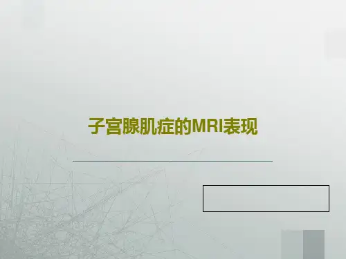 子宫腺肌症的MRI表现共32页