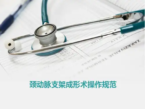 颈动脉支架成形术操作规范