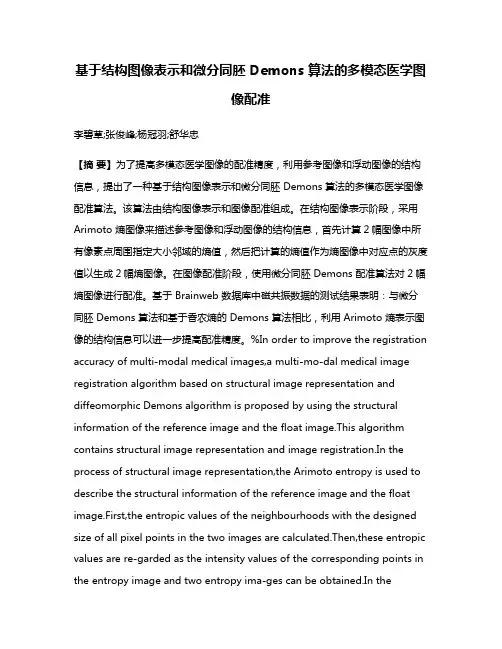 基于结构图像表示和微分同胚 Demons 算法的多模态医学图像配准