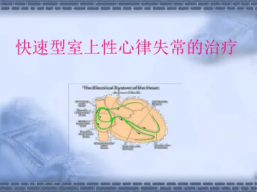 室上性心律失常的治疗