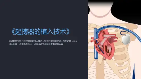 《起搏器的植入技术》课件