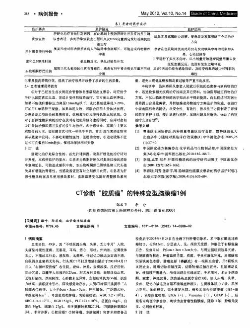 CT诊断“胶质瘤”的特殊变型脑膜瘤1例