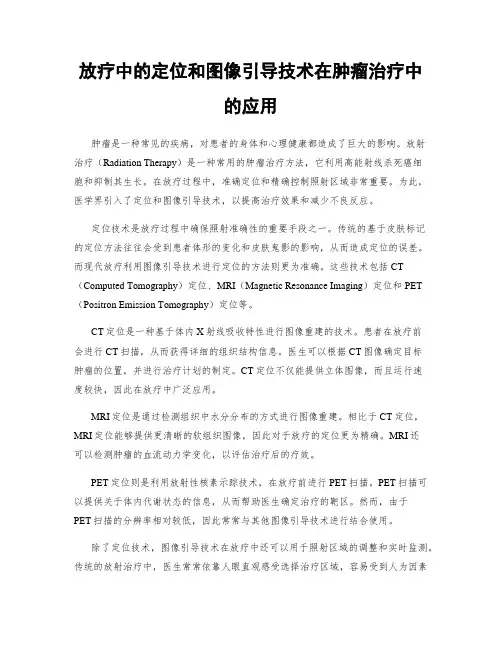 放疗中的定位和图像引导技术在肿瘤治疗中的应用