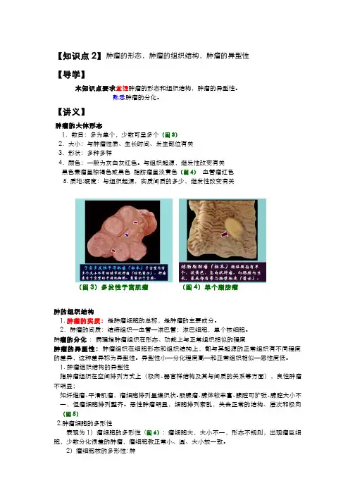 病理学 125-5-2肿瘤的形态,肿瘤的组织结构,肿瘤的异型性