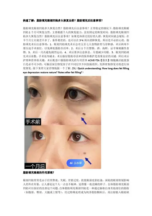 快速了解：脂肪填充眼部凹陷多久恢复自然？脂肪填充后注意事项？