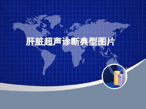 肝脏超声图片解析