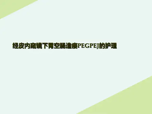 经皮内窥镜下胃空肠造瘘PEGPEJ的护理