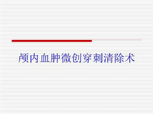 颅内血肿微创穿刺清除术培训课件